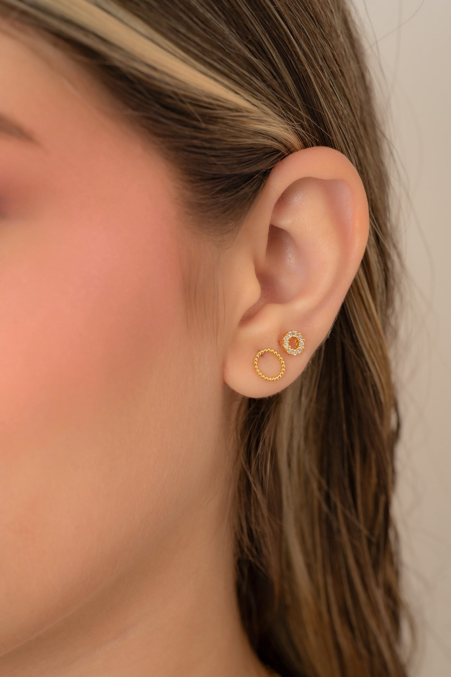 Arete Roma